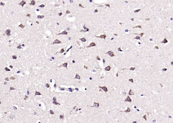 SFRP1 Rabbit Polyclonal Antibody