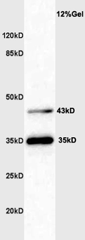 Shiga-like toxin IIe variant subunit A Rabbit Polyclonal Antibody