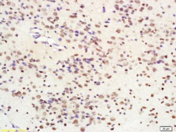 SIRT1 Rabbit Polyclonal Antibody