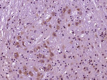 SIRT1 Rabbit Polyclonal Antibody