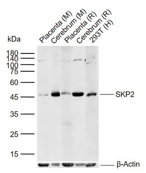 SKP2 Rabbit Polyclonal Antibody