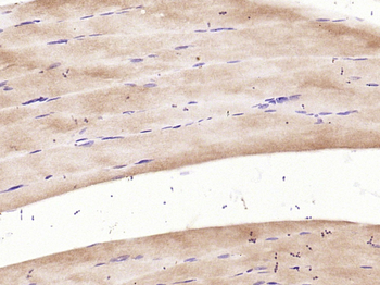 CACNA1S Rabbit Polyclonal Antibody