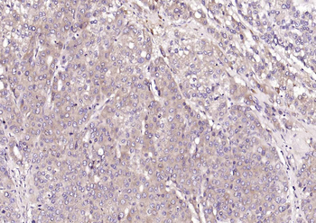 CRIM1 Rabbit Polyclonal Antibody