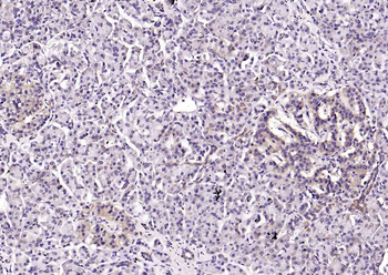 CRIM1 Rabbit Polyclonal Antibody