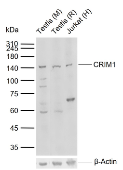 CRIM1 Rabbit Polyclonal Antibody