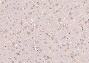 Smad2 Rabbit Polyclonal Antibody