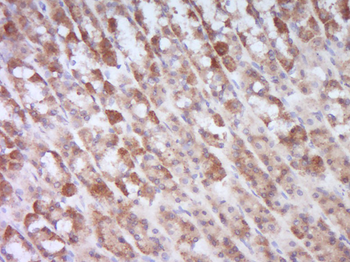 Smad4 Rabbit Polyclonal Antibody