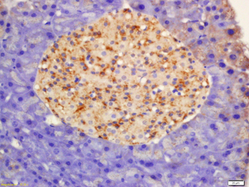 Smad4 Rabbit Polyclonal Antibody