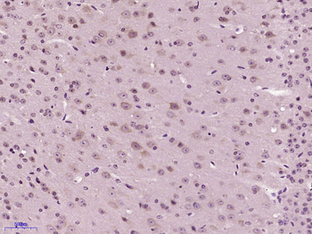SNAP25 Rabbit Polyclonal Antibody