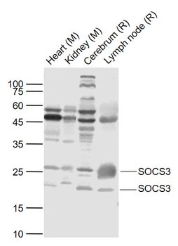 SOCS3 Rabbit Polyclonal Antibody