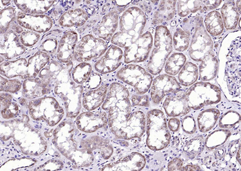 TPA Rabbit Polyclonal Antibody