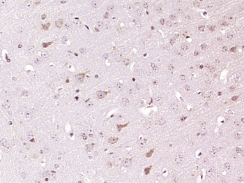 TPA Rabbit Polyclonal Antibody