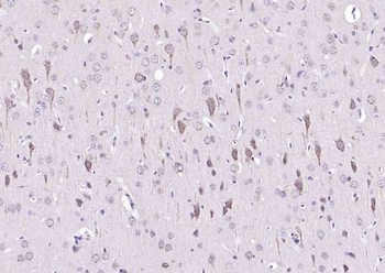 TPA Rabbit Polyclonal Antibody