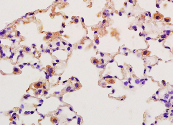 SFTPA1 Rabbit Polyclonal Antibody