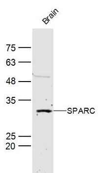 SPARC Rabbit Polyclonal Antibody
