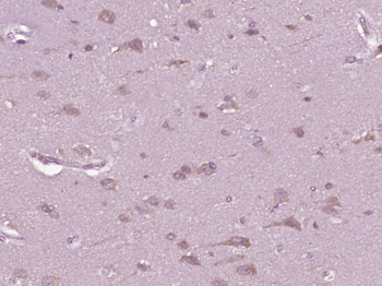 SPARC Rabbit Polyclonal Antibody