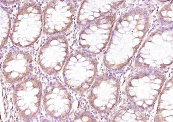 SPARC Rabbit Polyclonal Antibody