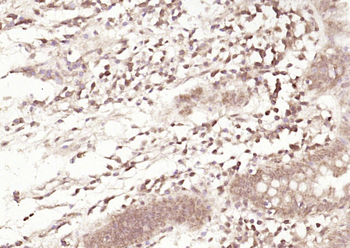 SPARC Rabbit Polyclonal Antibody