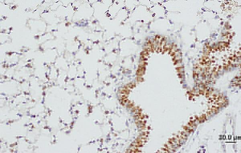 SFTPD Rabbit Polyclonal Antibody