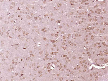 SRC Rabbit Polyclonal Antibody