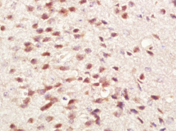 Phospho-Src (Tyr529) Rabbit Polyclonal Antibody