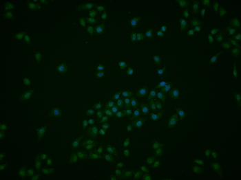 SRF Rabbit Polyclonal Antibody