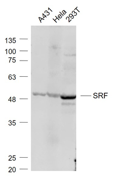 SRF Rabbit Polyclonal Antibody