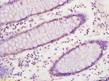 SREBP1 Rabbit Polyclonal Antibody