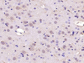 SREBP1 Rabbit Polyclonal Antibody