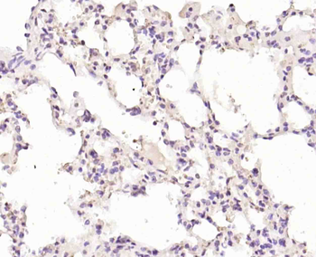 TRIM21 Rabbit Polyclonal Antibody