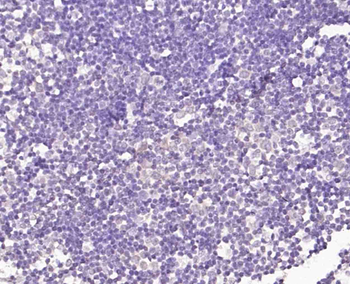 TRIM21 Rabbit Polyclonal Antibody