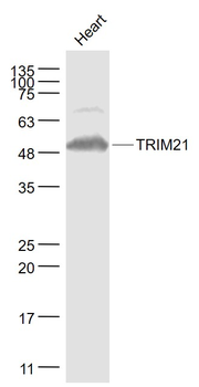 TRIM21 Rabbit Polyclonal Antibody