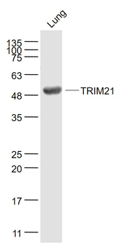 TRIM21 Rabbit Polyclonal Antibody