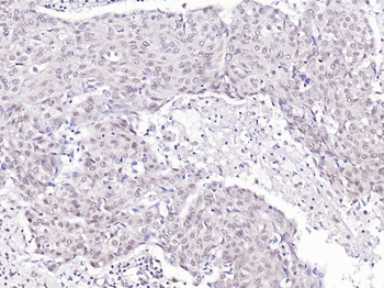 SSB Rabbit Polyclonal Antibody