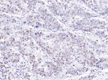 SSB Rabbit Polyclonal Antibody