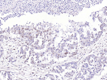 SSB Rabbit Polyclonal Antibody