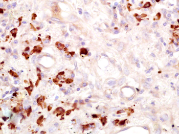 FUT4 Rabbit Polyclonal Antibody