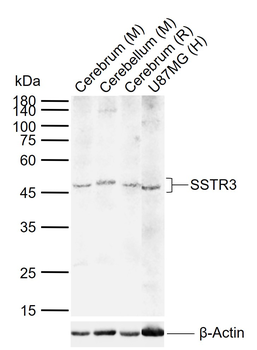 SSTR3 Rabbit Polyclonal Antibody