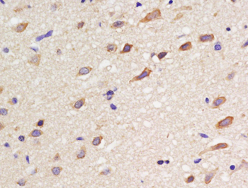 SSTR3 Rabbit Polyclonal Antibody