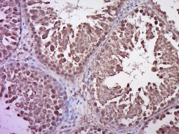 STAT1 Rabbit Polyclonal Antibody