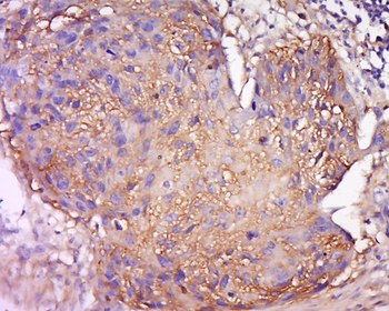 STAT2 Rabbit Polyclonal Antibody