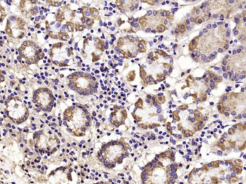 STAT6 Rabbit Polyclonal Antibody