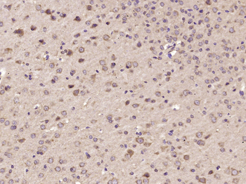 STAT6 Rabbit Polyclonal Antibody