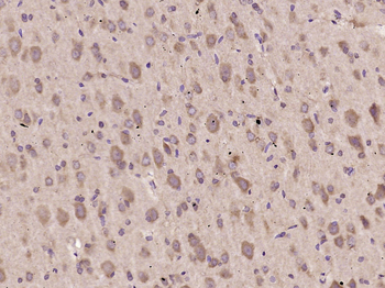 STAT6 Rabbit Polyclonal Antibody