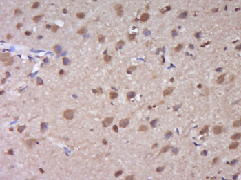 SUMO1 Rabbit Polyclonal Antibody