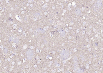 Alpha-Synuclein Rabbit Polyclonal Antibody