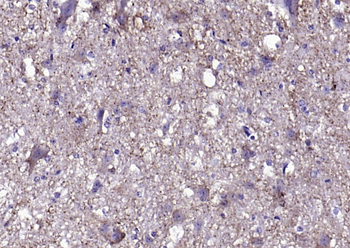 Alpha-Synuclein Rabbit Polyclonal Antibody