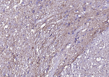 Alpha-Synuclein Rabbit Polyclonal Antibody