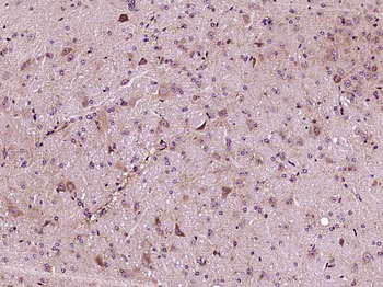 Apolipoprotein E Rabbit Polyclonal Antibody