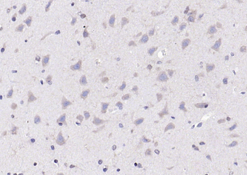 Apolipoprotein E Rabbit Polyclonal Antibody